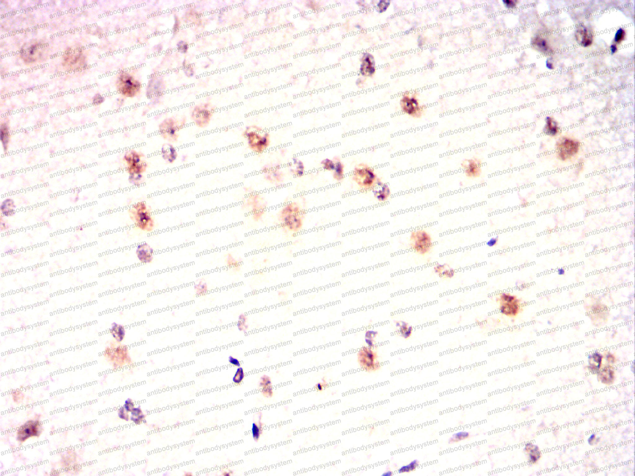 Валидация AntibodySystem RHJ44804