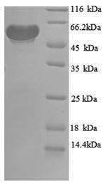 SDS-PAGE