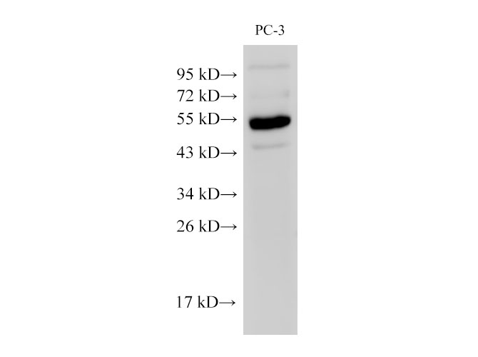 Вестерн-блоттинг, Chromogranin A, клетки PC-3