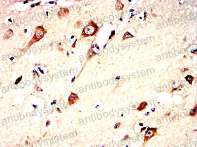 Валидация AntibodySystem RHK06402 (3613)