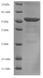 SDS-PAGE