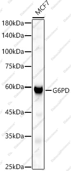 Вестерн-блоттинг, G6PD, клетки MCF7