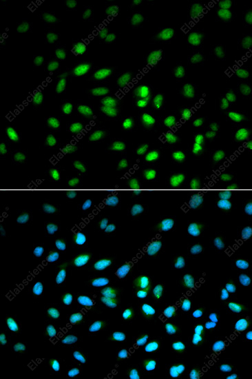 Иммунофлуоресценция, LKB1, клетки MCF-7