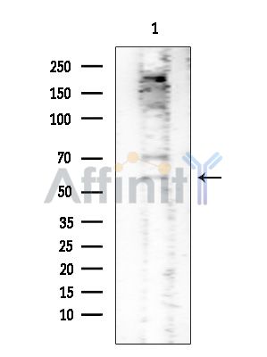 Валидация Affinity AF6176 - 3396
