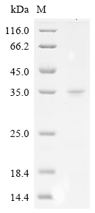 SDS-PAGE
