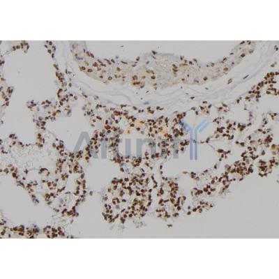 Валидация Affinity DF6851 - 18426