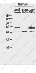 Вестерн-блоттинг, p53, клетки HepG2