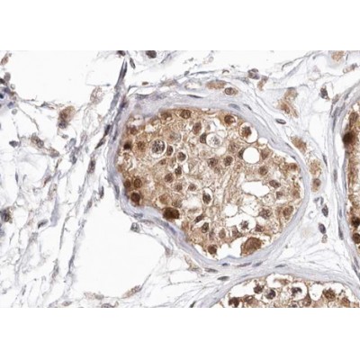 Валидация Affinity AF3485 - 2012