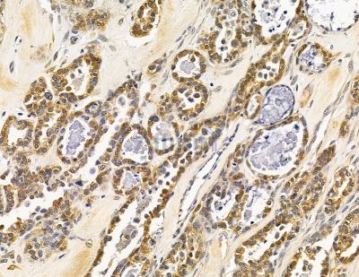 Валидация Affinity DF14916 - 11083