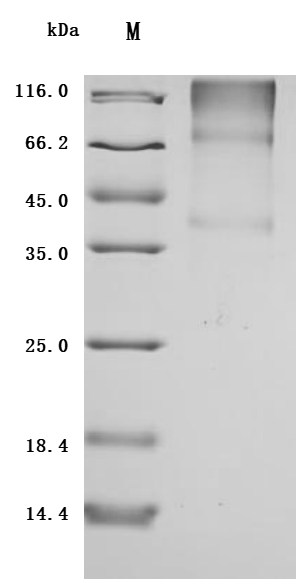 SDS-PAGE