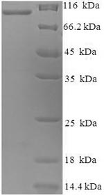 SDS-PAGE