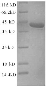 SDS-PAGE