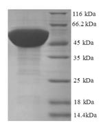SDS-PAGE