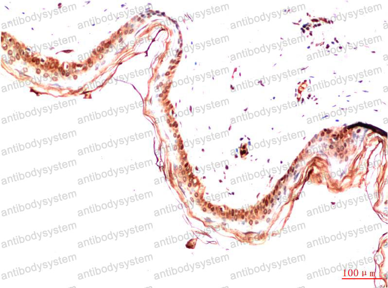 Валидация AntibodySystem RHD16107