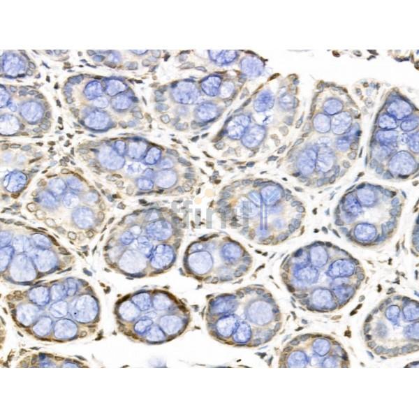 Валидация Affinity DF13663 - 9230