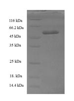 SDS-PAGE
