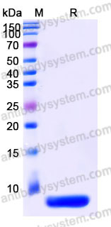YHD36002, SDS-PAGE