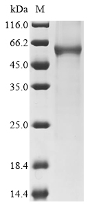 SDS-PAGE