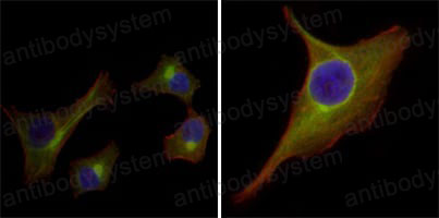 Валидация IF - AntibodySystem RHD31602