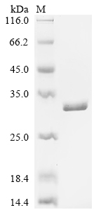 SDS-PAGE