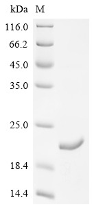 SDS-PAGE