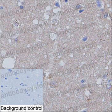 Валидация AntibodySystem RHF87204