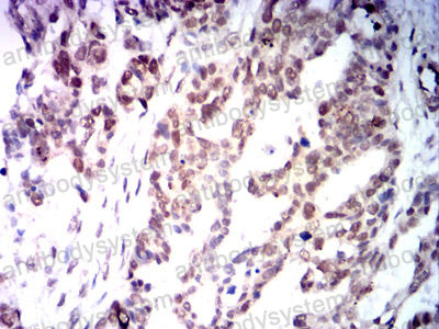 Валидация AntibodySystem RHE27606