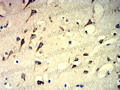 Валидация AntibodySystem RHD40502