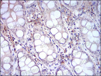 Валидация AntibodySystem RHC33704