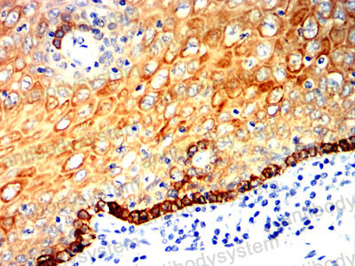 Валидация AntibodySystem RHB98005 (516)