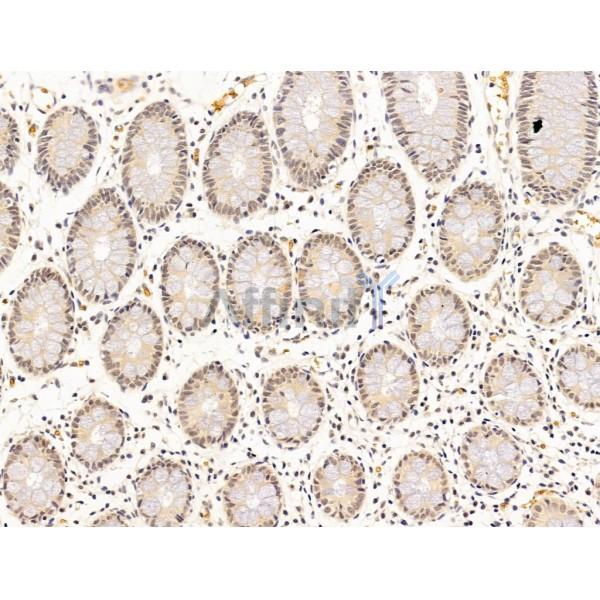 Валидация Affinity DF13612 - 9121