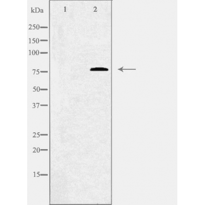 Валидация Affinity DF3961 - 15170