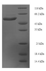 SDS-PAGE