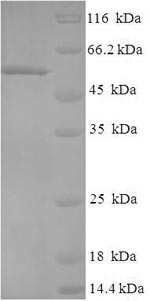 SDS-PAGE