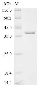 SDS-PAGE