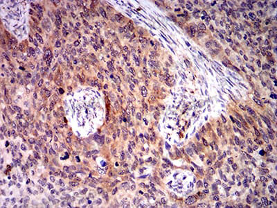 Валидация AntibodySystem RHA14008