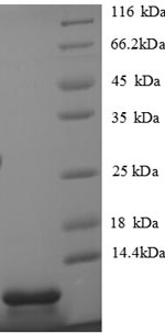 SDS-PAGE