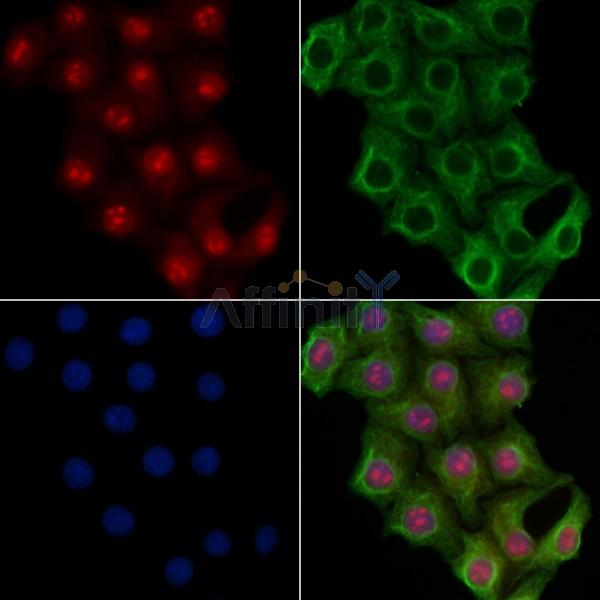 Валидация Affinity BF0722 - 5395