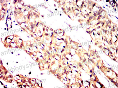 Валидация AntibodySystem RHN88904 (3920)