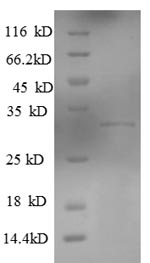 SDS-PAGE