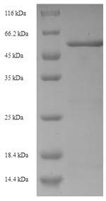 SDS-PAGE