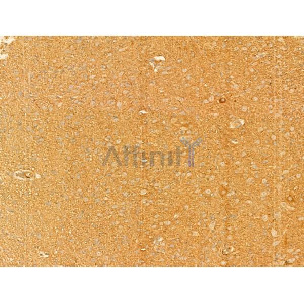 Валидация Affinity AF4200 - 2172