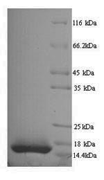 SDS-PAGE