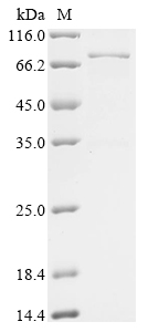 SDS-PAGE