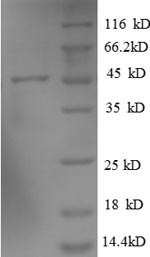 SDS-PAGE