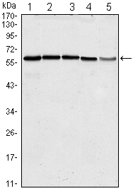 Валидация Affinity BF0380 - 5249