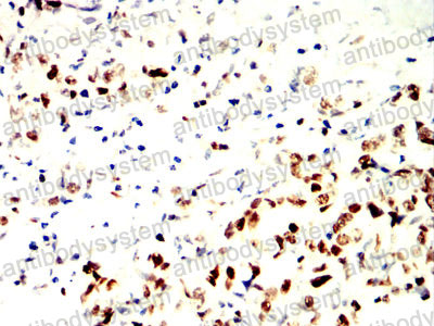 Валидация AntibodySystem RHD66502 (1701)