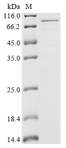 SDS-PAGE