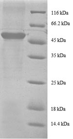 SDS-PAGE