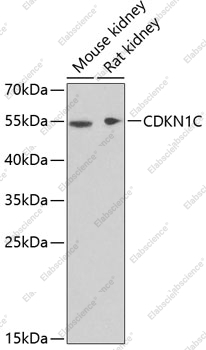 Вестерн-блоттинг, CDKN1C, различные клеточные линии